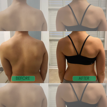 Zenlyft Posture Corrector for Back Pain Relief – Adjustable Upper Back & Shoulder Support Brace