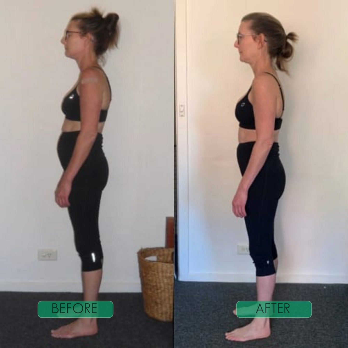 Zenlyft Posture Corrector for Back Pain Relief – Adjustable Upper Back & Shoulder Support Brace
